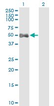 ALDH9A1 Antibody - Western Blot analysis of ALDH9A1 expression in transfected 293T cell line by ALDH9A1 monoclonal antibody (M01), clone 3C6.Lane 1: ALDH9A1 transfected lysate (Predicted MW: 53.8 KDa).Lane 2: Non-transfected lysate.