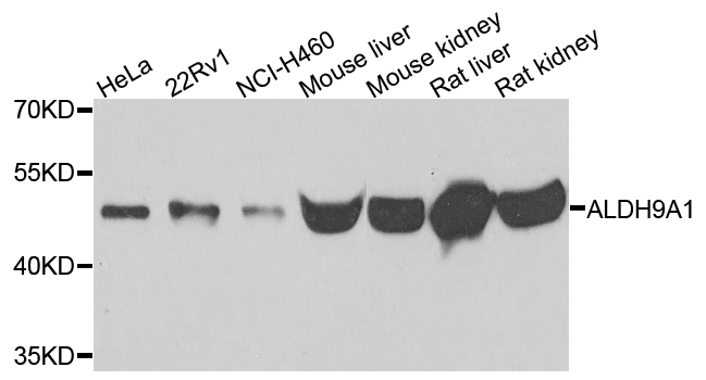 ALDH9A1 Antibody - Western blot analysis of extracts of various cells.