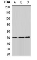 ALDH9A1 Antibody - Western blot analysis of ALDH9A1 expression in HeLa (A); mouse liver (B); rat kidney (C) whole cell lysates.
