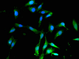 ALDH9A1 Antibody - Immunofluorescent analysis of Hela cells using ALDH9A1 Antibody at a dilution of 1:100 and Alexa Fluor 488-congugated AffiniPure Goat Anti-Rabbit IgG(H+L)