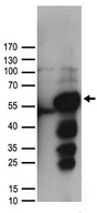 ALDH9A1 Antibody - HEK293T cells were transfected with the pCMV6-ENTRY control. (Left lane) or pCMV6-ENTRY ALDH9A1. (Right lane) cDNA for 48 hrs and lysed
