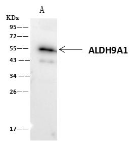ALDH9A1 Antibody - ALDH9A1 was immunoprecipitated using: Lane A: 0.5 mg Hela Whole Cell Lysate. 1 uL anti-ALDH9A1 rabbit polyclonal antibody and 60 ug of Immunomagnetic beads Protein A/G. Primary antibody: Anti-ALDH9A1 rabbit polyclonal antibody, at 1:500 dilution. Secondary antibody: Clean-Blot IP Detection Reagent (HRP) at 1:1000 dilution. Developed using the ECL technique. Performed under reducing conditions. Predicted band size: 54 kDa. Observed band size: 55 kDa.