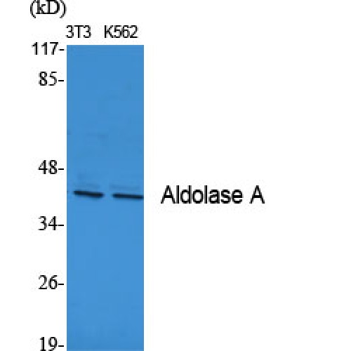 ALDOA / Aldolase A Antibody - Western blot of Aldolase A antibody