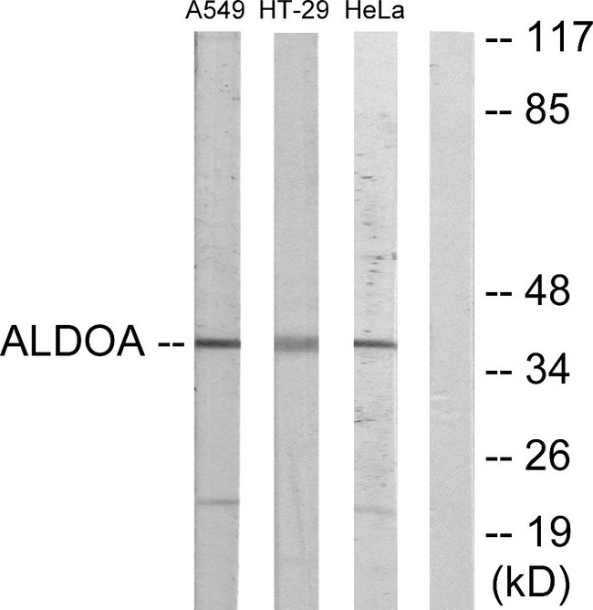 ALDOA / Aldolase A Antibody - Western blot analysis of lysates from A549, HeLa, and HT-29 cells, using ALDOA Antibody. The lane on the right is blocked with the synthesized peptide.