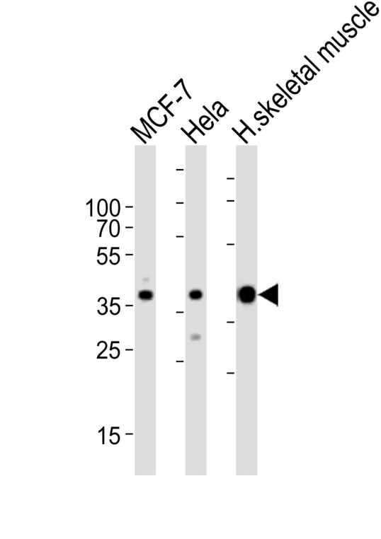 ALDOA / Aldolase A Antibody - Western blot of lysates from MCF-7, HeLa cell line and human skeletal muscle tissue lysate (from left to right), using ALDOA Antibody. Antibody was diluted at 1:1000 at each lane. A goat anti-rabbit IgG H&L (HRP) at 1:10000 dilution was used as the secondary antibody. Lysates at 35ug per lane.
