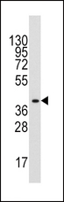 ALDOA / Aldolase A Antibody - Western blot of anti-ALDOA Antibody in mouse liver tissue lysates (35 ug/lane). ALDOA(arrow) was detected using the purified antibody.