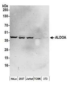 ALDOA / Aldolase A Antibody - Detection of human ALDOA by western blot. Samples: Whole cell lysate (50 µg) from HeLa, HEK293T, Jurkat, mouse TCMK-1, and mouse NIH 3T3 cells prepared using NETN lysis buffer. Antibodies: Affinity purified rabbit anti-ALDOA antibody used for WB at 0.1 µg/ml. Detection: Chemiluminescence with an exposure time of 3 minutes.