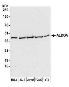 ALDOA / Aldolase A Antibody - Detection of human and mouse ALDOA by western blot. Samples: Whole cell lysate (50 µg) from HeLa, HEK293T, Jurkat, mouse TCMK-1, and mouse NIH 3T3 cells prepared using NETN lysis buffer. Antibodies: Affinity purified rabbit anti-ALDOA antibody used for WB at 0.1 µg/ml. Detection: Chemiluminescence with an exposure time of 30 seconds.