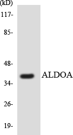ALDOA / Aldolase A Antibody - Western blot analysis of the lysates from HT-29 cells using ALDOA antibody.