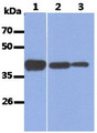 ALDOA / Aldolase A Antibody - The Recombinant Human ALDOA and Cell lysates (40ug) were resolved by SDS-PAGE, transferred to PVDF membrane and probed with anti-human ALDOA antibody (1:1000). Proteins were visualized using a goat anti-mouse secondary antibody conjugated to HRP and an ECL detection system. Lane 1.: Recombinant Human ALDOA Lane 2.: HeLa cell lysate Lane 3.: HepG2 cell lysate