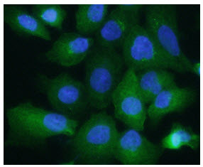 ALDOA / Aldolase A Antibody - ICC/IF analysis of ALDOA in A549 cells, stained with DAPI (Blue) for nucleus staining and monoclonal anti-human A549 antibody (1:200) with goat anti-mouse IgG-Alexa fluor 488 conjugate (Green).