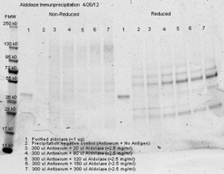 ALDOA / Aldolase A Antibody - Anti aldolase antibody– Immunoprecipitation- Immunoprecipitation was performed with 300 ul of anti aldolase antiserum and an equal volume of varied amounts (diluted from a stock solution of ~2.5 mg/ml) of purified aldolase in PBS.  Antibody/Antigen mixture was incubated ~24 hrs at 4°C, centrifuged for 6 minutes at 13K RPM, washed once with PBS, centrifuged and dissolved in 60 ul 0.1 N NaOH.  90 ul of PBS was added, the sample was divided in 2 portions, and an equal volume of reducing (+4% BME) or non-reducing 2X sample buffer was added.  The reduced samples were boiled for five minutes, and all samples were run at 140 V for ~45 minutes on a 4-20% tris/glycine gradient gel.  Gel was stained, destained and imaged(see attached) using standard protocols.  Precipitation of aldolase was confirmed by comparison of increasing amounts of antigen with the control protein by SDS PAGE and observation of a 40-45 kD MW band corresponding to Aldolase.  Additional higher and lower molecular weight bands correspond to serum proteins.