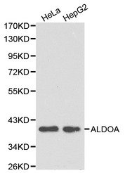 ALDOA / Aldolase A Antibody - Western blot of ALDOA pAb in extracts from Hela and HepG2 cells.