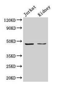 ALDOA / Aldolase A Antibody - Western blot All lanes: Fructose-bisphosphate aldolase A polyclonal antibody at 2µg/ml + EC109 whole cell lysate Secondary Goat polyclonal to rabbit IgG at 1/15000 dilution Predicted band size: 40, 46 kDa Observed band size: 40 kDa