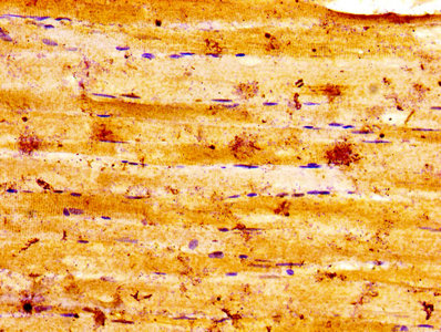 ALDOA / Aldolase A Antibody - IHC image of ALDOA Antibody diluted at 1:100 and staining in paraffin-embedded human skeletal muscle tissue performed on a Leica BondTM system. After dewaxing and hydration, antigen retrieval was mediated by high pressure in a citrate buffer (pH 6.0). Section was blocked with 10% normal goat serum 30min at RT. Then primary antibody (1% BSA) was incubated at 4°C overnight. The primary is detected by a biotinylated secondary antibody and visualized using an HRP conjugated SP system.