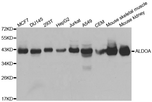 ALDOA / Aldolase A Antibody - Western blot analysis of extracts of various cell lines, using ALDOA antibody at 1:1000 dilution. The secondary antibody used was an HRP Goat Anti-Rabbit IgG (H+L) at 1:10000 dilution. Lysates were loaded 25ug per lane and 3% nonfat dry milk in TBST was used for blocking. An ECL Kit was used for detection and the exposure time was 2s.