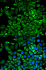 ALDOA / Aldolase A Antibody - Immunofluorescence analysis of A549 cells using ALDOA antibody. Blue: DAPI for nuclear staining.