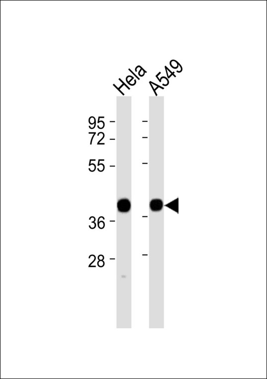 ALDOA / Aldolase A Antibody - All lanes : Anti-ALDOA Antibody at 1:1000 dilution Lane 1: HeLa whole cell lysates Lane 2: A549 whole cell lysates Lysates/proteins at 20 ug per lane. Secondary Goat Anti-Rabbit IgG, (H+L),Peroxidase conjugated at 1/10000 dilution Predicted band size : 39 kDa Blocking/Dilution buffer: 5% NFDM/TBST.