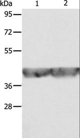 ALDOA / Aldolase A Antibody - Western blot analysis of A549 and HeLa cell, using ALDOA Polyclonal Antibody at dilution of 1:500.
