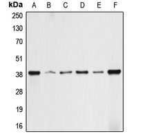ALDOA / Aldolase A Antibody - Western blot analysis of ALDOA expression in HEK293T (A); HepG2 (B); HeLa (C); NIH3T3 (D); PC12 (E); rat skeletal muscle (F) whole cell lysates.