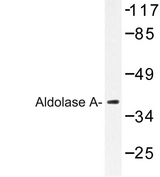 ALDOA / Aldolase A Antibody - Western blot of Aldolase A (T9) pAb in extracts from COLO205 cells.