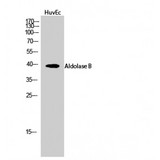 ALDOB Antibody - Western blot of Aldolase B antibody