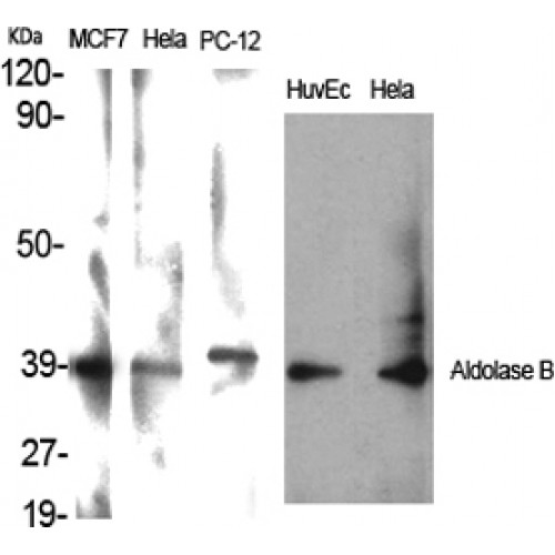 ALDOB Antibody - Western blot of Aldolase B antibody