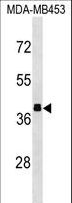 ALDOB Antibody - ALDOB Antibody western blot of MDA-MB453 cell line lysates (35 ug/lane). The ALDOB antibody detected the ALDOB protein (arrow).