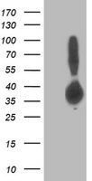 ALDOB Antibody - HEK293T cells were transfected with the pCMV6-ENTRY control (Left lane) or pCMV6-ENTRY ALDOB (Right lane) cDNA for 48 hrs and lysed. Equivalent amounts of cell lysates (5 ug per lane) were separated by SDS-PAGE and immunoblotted with anti-ALDOB.
