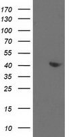ALDOB Antibody - HEK293T cells were transfected with the pCMV6-ENTRY control (Left lane) or pCMV6-ENTRY ALDOB (Right lane) cDNA for 48 hrs and lysed. Equivalent amounts of cell lysates (5 ug per lane) were separated by SDS-PAGE and immunoblotted with anti-ALDOB.
