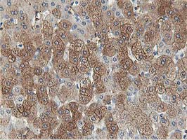 ALDOB Antibody - IHC of paraffin-embedded Human liver tissue using anti-ALDOB mouse monoclonal antibody.