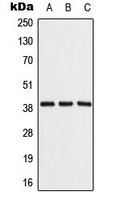 ALDOB Antibody - Western blot analysis of ALDOB expression in Raji (A); NIH3T3 (B); rat liver (C) whole cell lysates.