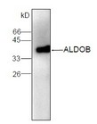 ALDOB Antibody