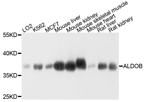 ALDOB Antibody - Western blot analysis of extracts of Mouse kidney cells.