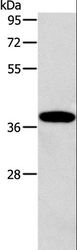 ALDOB Antibody - Western blot analysis of Human fetal liver tissue, using ALDOB Polyclonal Antibody at dilution of 1:260.