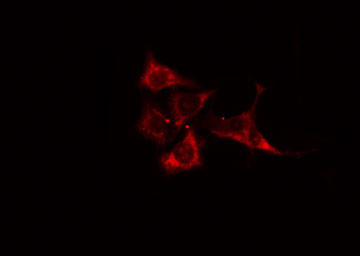 ALDOB Antibody - Staining MCF-7 cells by IF/ICC. The samples were fixed with PFA and permeabilized in 0.1% Triton X-100, then blocked in 10% serum for 45 min at 25°C. The primary antibody was diluted at 1:200 and incubated with the sample for 1 hour at 37°C. An Alexa Fluor 594 conjugated goat anti-rabbit IgG (H+L) antibody, diluted at 1/600, was used as secondary antibody.