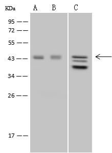 ALDOB Antibody - Anti-ALDOB rabbit polyclonal antibody at 1:500 dilution. Lane A: HeLa Whole Cell Lysate. Lane B: 293T Whole Cell Lysate. Lane C: Jurkat Whole Cell Lysate. Lysates/proteins at 30 ug per lane. Secondary: Goat Anti-Rabbit IgG (H+L)/HRP at 1/10000 dilution. Developed using the ECL technique. Performed under reducing conditions. Predicted band size: 39 kDa. Observed band size: 43 kDa. (We are unsure as to the identity of these extra bands.)