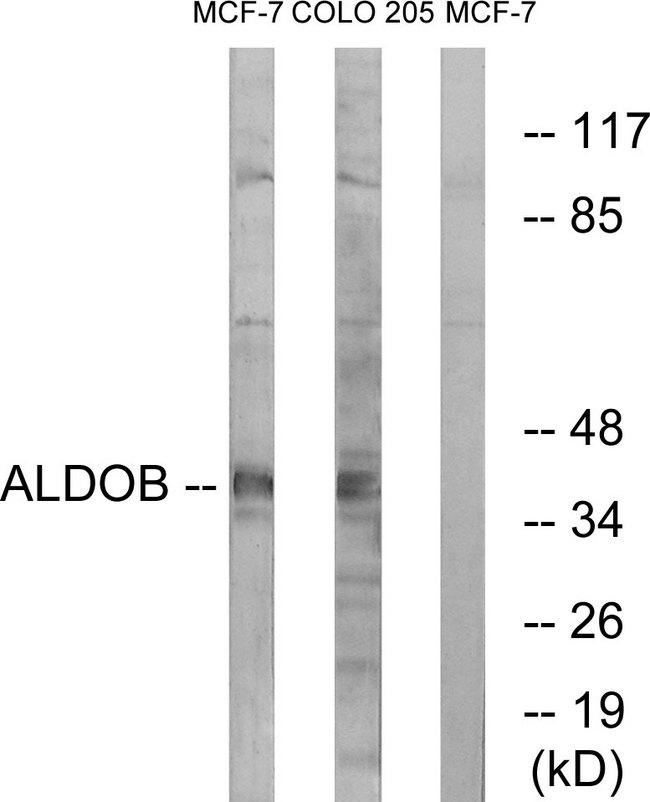 ALDOB Antibody - Western blot analysis of extracts from MCF-7 cells and HUVEC cells, using ALDOB antibody.