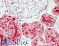 ALDOB Antibody - Human Kidney: Formalin-Fixed, Paraffin-Embedded (FFPE).  This image was taken for the unconjugated form of this product. Other forms have not been tested.