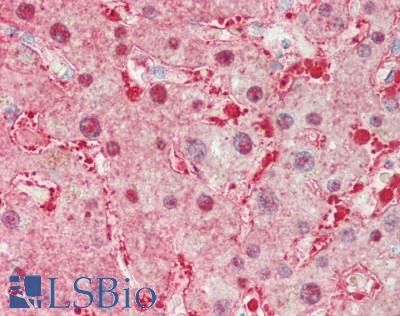 ALDOB Antibody - Human Liver: Formalin-Fixed, Paraffin-Embedded (FFPE).  This image was taken for the unconjugated form of this product. Other forms have not been tested.