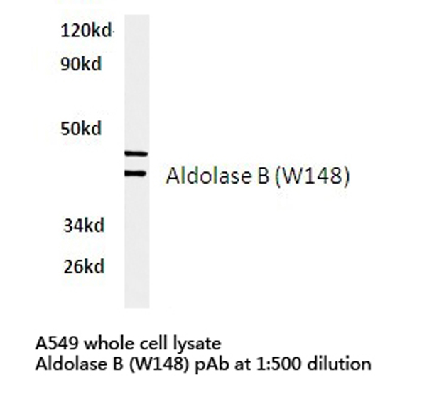 ALDOB Antibody - Western blot of Aldolase B (W148) pAb in extracts from A549 cells.