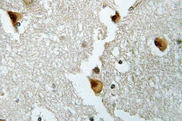ALDOB Antibody - IHC of Aldolase B (W148) pAb in paraffin-embedded human brain tissue.