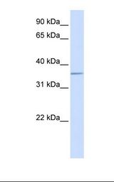ALDOC / Aldolase C Antibody - Placenta lysate. Antibody concentration: 1.0 ug/ml. Gel concentration: 12%.  This image was taken for the unconjugated form of this product. Other forms have not been tested.