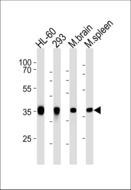 ALDOC / Aldolase C Antibody - ALDOC Antibody western blot of HL-60,293 cell line and mouse brain,spleen lysates (35 ug/lane). The ALDOC antibody detected the ALDOC protein (arrow).