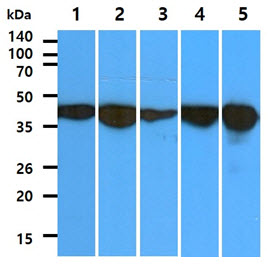 ALDOC / Aldolase C Antibody - The cell line and tissue lysates (40ug) were resolved by SDS-PAGE, transferred to PVDF membrane and probed with anti-human ALDOC antibody (1:1000). Proteins were visualized using a goat anti-mouse secondary antibody conjugated to HRP and an ECL detection system. Lane 1. : PC3 cell lysate Lane 2. : U87MG cell lysate Lane 3. : WiDr cell lysate Lane 4. : Jurkat cell lysate Lane 5. : Mouse brain tissue lysate