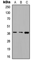 ALDOC / Aldolase C Antibody - Western blot analysis of ALDOC expression in A549 (A); PC12 (B); Raw264.7 (C) whole cell lysates.