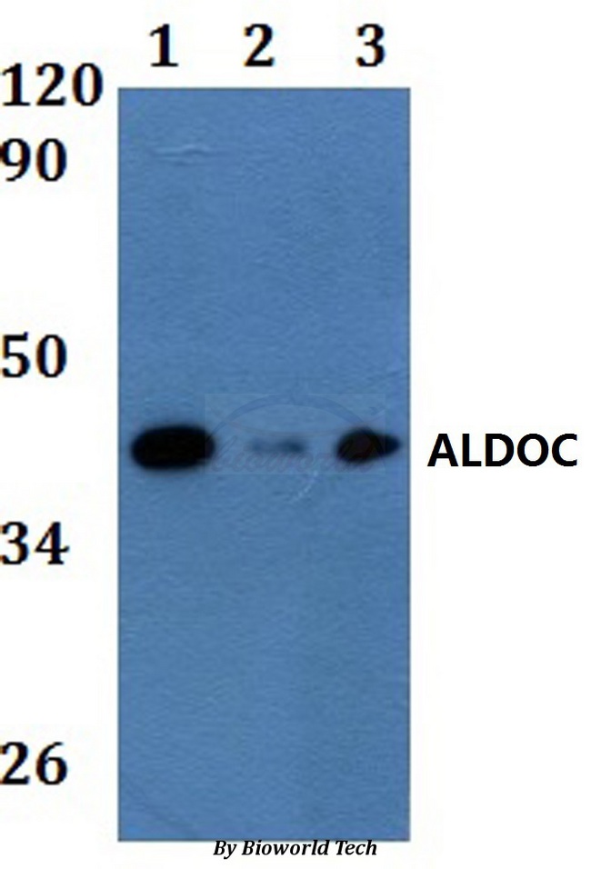 ALDOC / Aldolase C Antibody - Western blot of ALDOC antibody at 1:500 dilution. Lane 1: A549 whole cell lysate. Lane 2: PC12 whole cell lysate. Lane 3: Raw264.7 whole cell lysate.