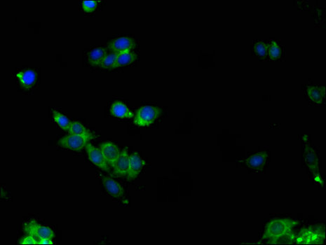 ALDOC / Aldolase C Antibody - Immunofluorescent analysis of HepG2 cells using ALDOC Antibody at a dilution of 1:100 and Alexa Fluor 488-congugated AffiniPure Goat Anti-Rabbit IgG(H+L)