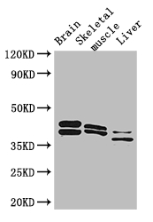 ALDOC / Aldolase C Antibody - Positive WB detected in:Mouse brain tissue,Mouse skeletal muscle tissue,Mouse liver tissue;All lanes: ALDOC antibody at 3ug/ml;Secondary;Goat polyclonal to rabbit IgG at 1/50000 dilution;Predicted band size: 40 kDa;Observed band size: 40,36,42 kDa;