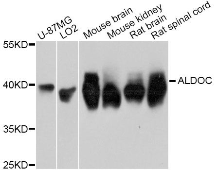 ALDOC / Aldolase C Antibody - Western blot analysis of extracts of various cell lines, using ALDOC Antibody at 1:3000 dilution. The secondary antibody used was an HRP Goat Anti-Rabbit IgG (H+L) at 1:10000 dilution. Lysates were loaded 25ug per lane and 3% nonfat dry milk in TBST was used for blocking. An ECL Kit was used for detection and the exposure time was 3s.